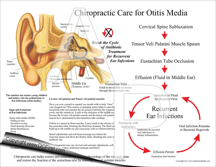Chiropractic Treatment of Ear Infections Pad Chiropractic Treatment of Ear Infections Pad