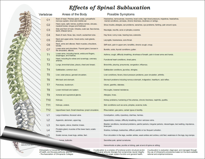 Vertebral Spinal Subluxation Symptoms Handouts Vertebral Spinal Subluxation Symptoms Handout