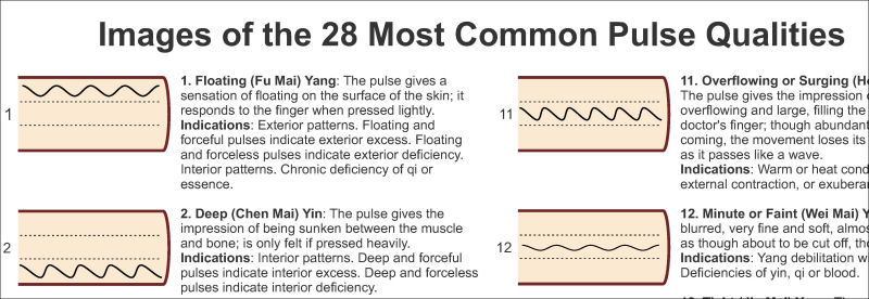 Pulse Diagnosis Qualities Poster Pulse Diagnosis Poster