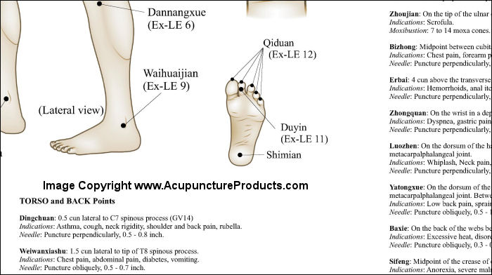 Extraordinary Acupuncture Points Poster Extraordinary Acupuncture Points Poster